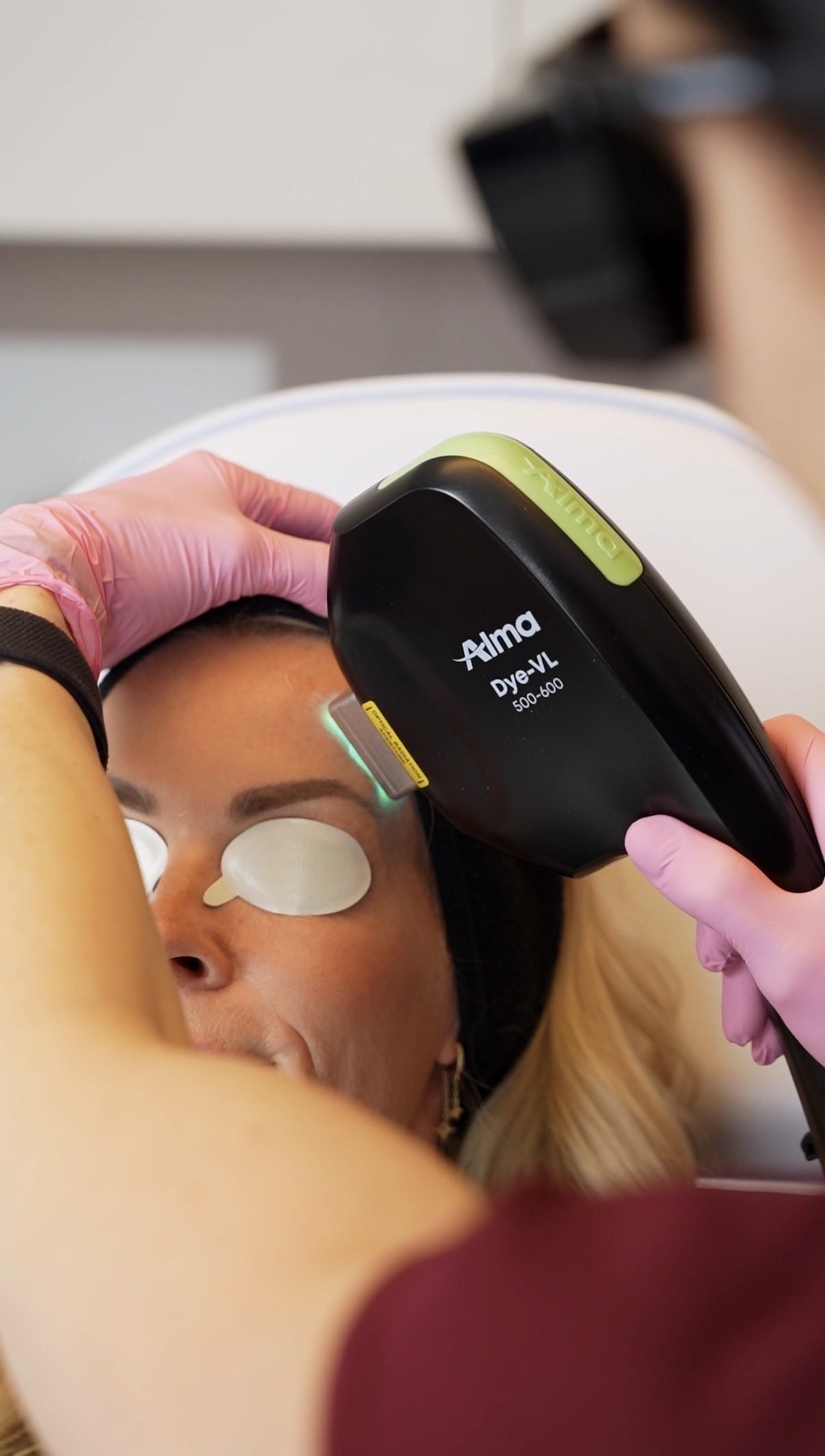 Laserbehandling med Alma Harmony XL Pro